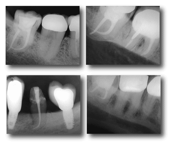 Radiografias especializacion